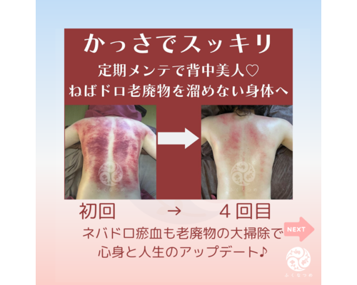 【浦和　かっさ】～よくある質問～デトックスかっさって痛いの？