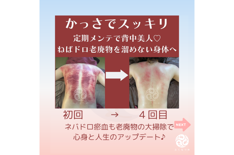 【浦和　かっさ】～よくある質問～デトックスかっさって痛いの？