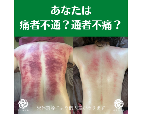 【浦和　かっさ】～よくある質問～デトックスかっさって痛いの？